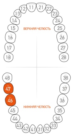 Кламп удерживающий для повязок и ватных ролов Dentech (Япония) G1
